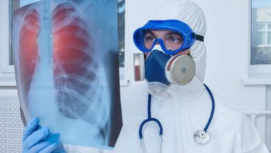 un medico con maschera di protezione analizza una lastra ai polmoni