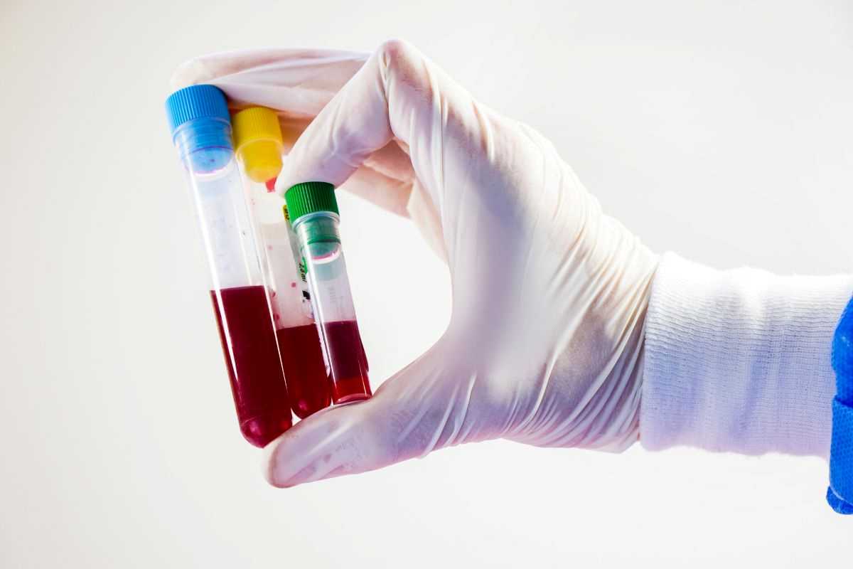 provette sangue