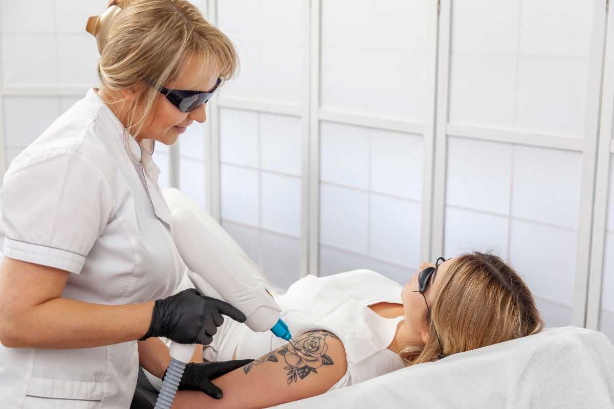 come funziona la rimozione di un tatuaggio con laser